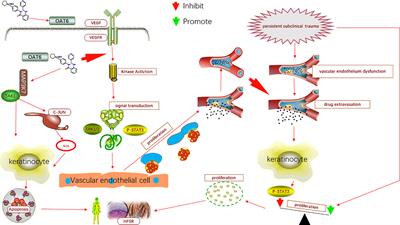 Apatinib-Induced Hand–Foot Skin Reaction in Chinese Patients With Liver Cancer